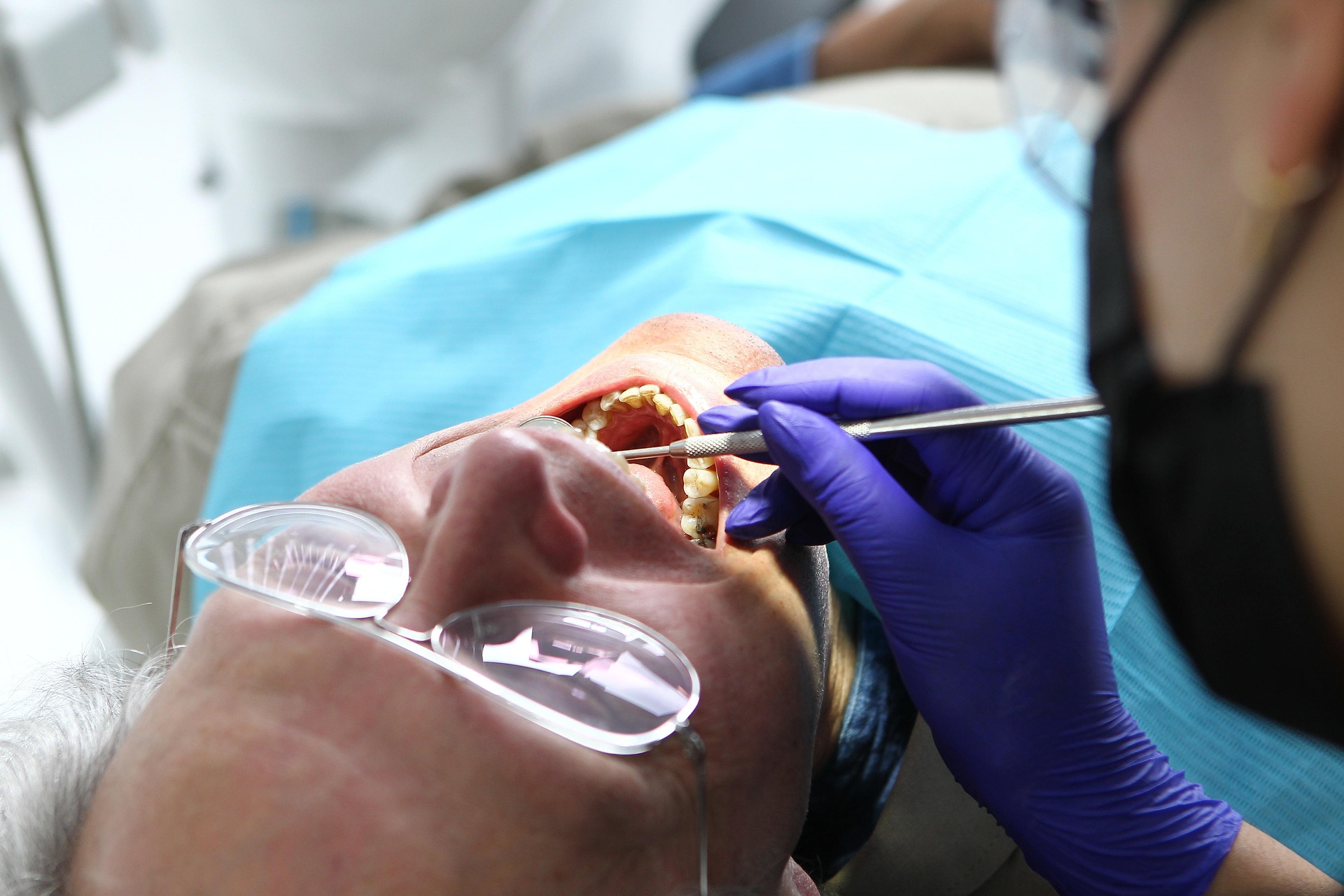 Limpieza dental